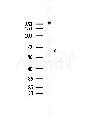 Phospho-Estrogen Receptor alpha (Ser118) Antibody - Western blot analysis of lysates from EC304 cells, using Phospho-Estrogen Receptor alpha (Ser118) Antibody at 1/1000 dilution.