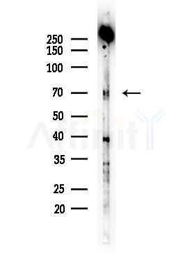 Phospho-C-RAF (Ser296) Antibody - Western blot analysis of lysates from Rat brain, using Phospho-C-RAF (Ser296) Antibody at 1/1000 dilution.