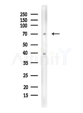 Phospho-C-RAF (Ser296) Antibody - Western blot analysis of lysates from COLO205 cells, using Phospho-C-RAF (Ser296) Antibody at 1/1000 dilution.