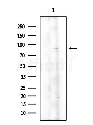 Phospho-NR3C1 (Ser203) Antibody - Western blot analysis of lysates from Rat brain, using Phospho-NR3C1 (Ser203) Antibody at 1/1000 dilution.