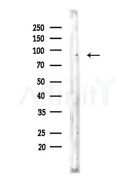 Phospho-NR3C1 (Ser203) Antibody - Western blot analysis of lysates from Rat brain, using Phospho-NR3C1 (Ser203) Antibody at 1/1000 dilution.