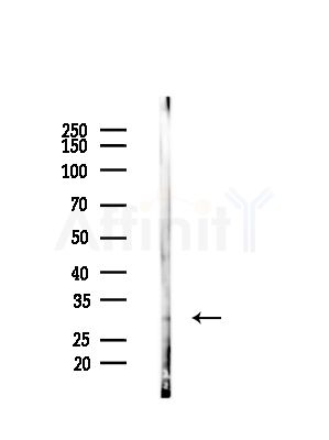 Phospho-Thymidine Kinase 1/TK1 (Ser13) Antibody - Western blot analysis of lysates from EC304 cells, using Phospho-Thymidine Kinase 1/TK1 (Ser13) Antibody at 1/1000 dilution.