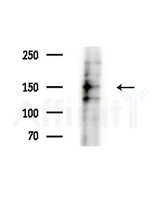 Phospho-HER2/ErbB2 (Tyr877) Antibody - Western blot analysis of extracts from B16F10-LUC cells(LPS,4h treatment), using Phospho-HER2/ErbB2 (Tyr877) Antibody at 1/1000 dilution.