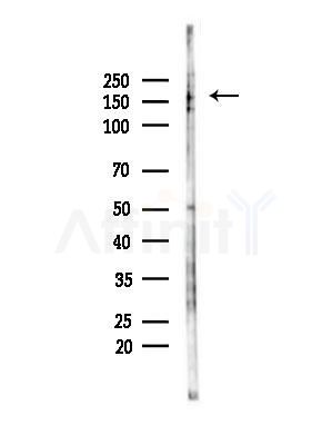 Phospho-HER2/ErbB2 (Tyr877) Antibody - Western blot analysis of lysates from B16F10-LUC cells(LPS,4h treatment), using Phospho-HER2/ErbB2 (Tyr877) Antibody at 1/1000 dilution.