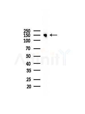 Phospho-HER2/ErbB2 (Tyr1112) Antibody - Western blot analysis of lysates from LoVo cells(heat-shock,45min treatment), using Phospho-HER2/ErbB2 (Tyr1112) Antibody at 1/1000 dilution.
