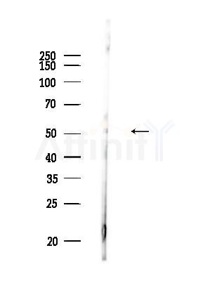 Phospho-p53 (Ser392) Antibody - Western blot analysis of lysates from Raji cells(heat-shock,45min treatment), using Phospho-p53 (Ser392) Antibody at 1/1000 dilution.