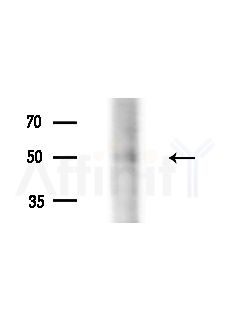 Phospho-p53 (Ser315) Antibody - Western blot analysis of lysates from B16F10-LUC cells(LPS,4h treatment), using Phospho-p53 (Ser315) Antibody at 1/1000 dilution.