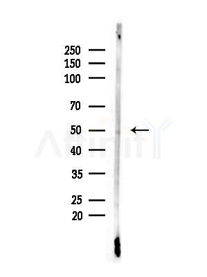 Phospho-p53 (Ser315) Antibody - Western blot analysis of lysates from B16F10-LUC cells(LPS,4h treatment), using Phospho-p53 (Ser315) Antibody at 1/1000 dilution.