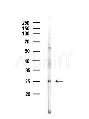 Phospho-HSP27 (Ser78) Antibody - Western blot analysis of lysates from COLO205 cells(heat-shock,45min treatment), using Phospho-HSP27 (Ser78) Antibody at 1/1000 dilution.