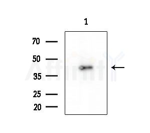 Phospho-c-Jun (Ser243) Antibody - Western blot analysis of extracts from EC304 cells, using Phospho-c-Jun (Ser243) Antibody at 1/1000 dilution.