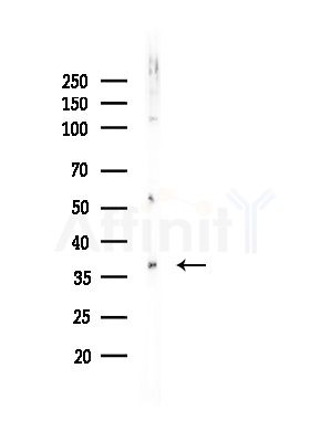Phospho-c-Jun (Ser243) Antibody - Western blot analysis of lysates from EC304 cells, using Phospho-c-Jun (Ser243) Antibody at 1/1000 dilution.