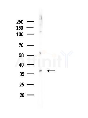Phospho-c-Jun (Ser243) Antibody - Western blot analysis of lysates from EC304 cells, using Phospho-c-Jun (Ser243) Antibody at 1/1000 dilution.