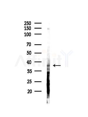 Phospho-c-Jun (Thr93) Antibody - Western blot analysis of lysates from HepG2 cells(heat-shock,45min treatment), using Phospho-c-Jun (Thr93) Antibody at 1/1000 dilution.