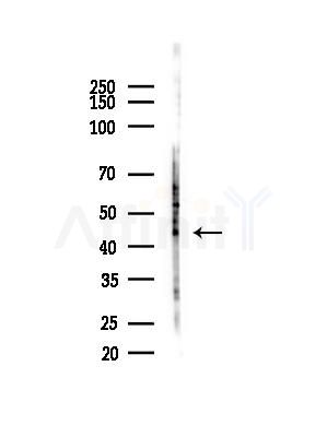Phospho-c-Jun (Tyr170) Antibody - Western blot analysis of lysates from COLO205 cells(heat-shock,45min treatment), using Phospho-c-Jun (Tyr170) Antibody at 1/1000 dilution.