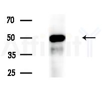 Phospho-Cytokeratin 8 (Ser432) Antibody - Western blot analysis of extracts from HepG2 cells(heat-shock treatment), using Phospho-Cytokeratin 8 (Ser432) Antibody at 1/1000 dilution.