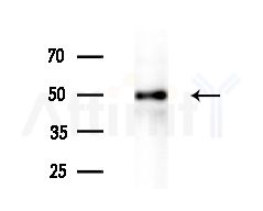 Phospho-Cytokeratin 8 (Ser432) Antibody - Western blot analysis of extracts from Hela cells(heat-shock treatment), using Phospho-Cytokeratin 8 (Ser432) Antibody at 1/1000 dilution.