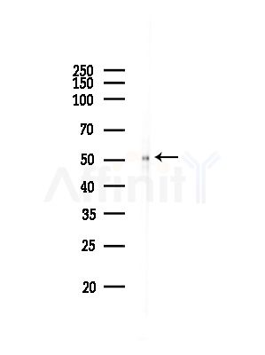 Phospho-Cytokeratin 8 (Ser432) Antibody - Western blot analysis of lysates from Hela cells(heat-shock,45min treatment), using Phospho-Cytokeratin 8 (Ser432) Antibody at 1/1000 dilution.