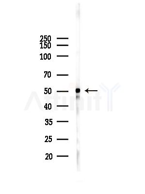 Phospho-Cytokeratin 8 (Ser432) Antibody - Western blot analysis of lysates from HepG2 cells(heat-shock,45min treatment), using Phospho-Cytokeratin 8 (Ser432) Antibody at 1/1000 dilution.