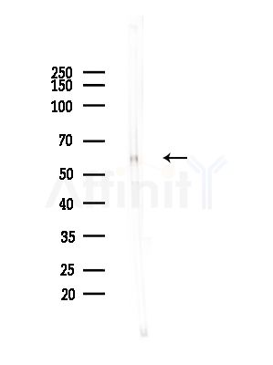 Phospho-Fyn (Tyr530)[Tyr531] Antibody - Western blot analysis of lysates from Mouse brain, using Phospho-Fyn (Tyr530)[Tyr531] Antibody at 1/1000 dilution.