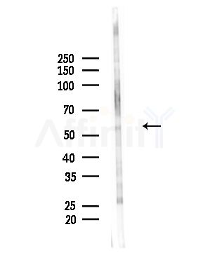 Phospho-Fyn (Tyr530)[Tyr531] Antibody - Western blot analysis of lysates from A375 cells(heat-shock,45min treatment), using Phospho-Fyn (Tyr530)[Tyr531] Antibody at 1/1000 dilution.