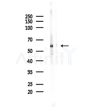 Phospho-Fyn (Tyr530)[Tyr531] Antibody - Western blot analysis of lysates from Hela cells(UV,30min treatment), using Phospho-Fyn (Tyr530)[Tyr531] Antibody at 1/1000 dilution.