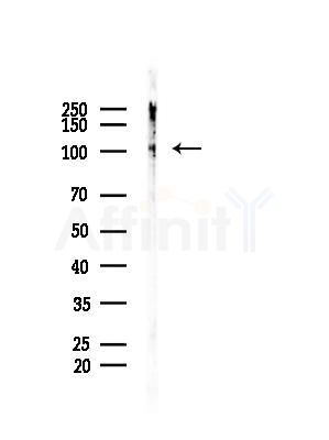 Phospho-Retinoblastoma (Ser780) Antibody - Western blot analysis of lysates from HUVEC cells, using Phospho-Retinoblastoma (Ser780) Antibody at 1/1000 dilution.