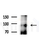 Phospho-Retinoblastoma (Ser795) Antibody - Western blot analysis of extracts from COLO205 cells(heat-shock,45min treatment), using Phospho-Retinoblastoma (Ser795) Antibody at 1/1000 dilution.