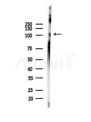 Phospho-Retinoblastoma (Ser795) Antibody - Western blot analysis of lysates from COLO205 cells(heat-shock,45min treatment), using Phospho-Retinoblastoma (Ser795) Antibody at 1/1000 dilution.