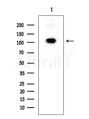 Phospho-Retinoblastoma (Ser807) Antibody - Western blot analysis of extracts from K562 cells, using Phospho-Retinoblastoma (Ser807) Antibody at 1/1000 dilution.