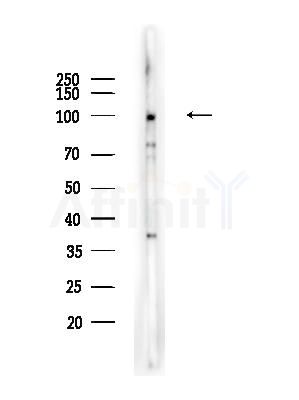 Phospho-Retinoblastoma (Ser807) Antibody - Western blot analysis of lysates from K562 cells, using Phospho-Retinoblastoma (Ser807) Antibody at 1/1000 dilution.