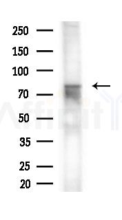 Phospho-Progesterone Receptor (Ser294) Antibody - Western blot analysis of extracts from HepG2 cells(heat-shock,45min treatment), using Phospho-Progesterone Receptor (Ser294) Antibody at 1/1000 dilution.