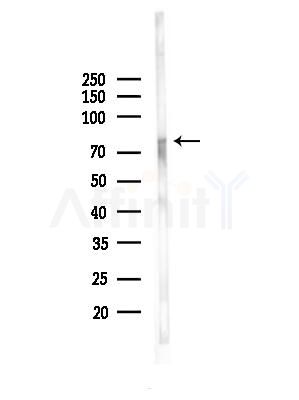 Phospho-Progesterone Receptor (Ser294) Antibody - Western blot analysis of lysates from HepG2 cells(heat-shock,45min treatment), using Phospho-Progesterone Receptor (Ser294) Antibody at 1/1000 dilution.