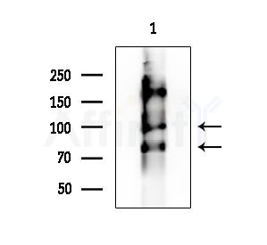 Phospho-Progesterone Receptor (Ser400) Antibody - Western blot analysis of extracts from Mouse testis, using Phospho-Progesterone Receptor (Ser400) Antibody at 1/1000 dilution.