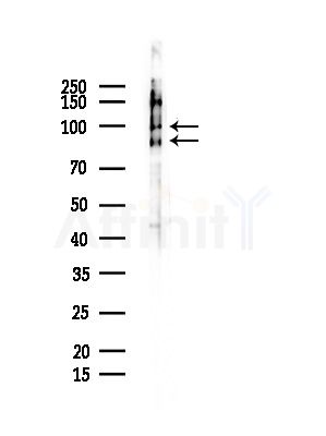 Phospho-Progesterone Receptor (Ser400) Antibody - Western blot analysis of lysates from Mouse testis, using Phospho-Progesterone Receptor (Ser400) Antibody at 1/1000 dilution.