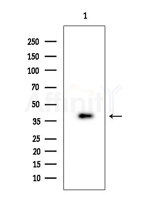 Phospho-Nucleophosmin (Thr199) Antibody - Western blot analysis of extracts from K562 cells, using Phospho-Nucleophosmin (Thr199) Antibody at 1/1000 dilution.
