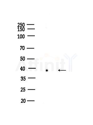 Phospho-Nucleophosmin (Thr199) Antibody - Western blot analysis of lysates from K562 cells, using Phospho-Nucleophosmin (Thr199) Antibody at 1/1000 dilution.