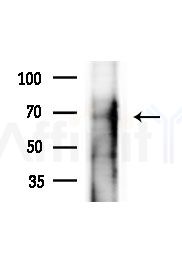 Phospho-Tyrosine Hydroxylase (Ser19) Antibody - Western blot analysis of lysates from COLO205 cells(heat-shock,45min treatment), using Phospho-Tyrosine Hydroxylase (Ser19) Antibody at 1/1000 dilution.