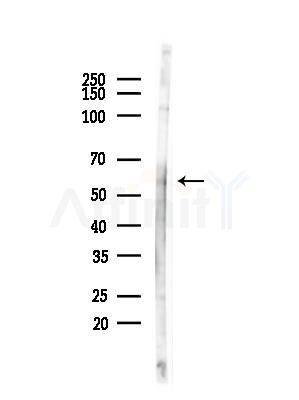 Phospho-Tyrosine Hydroxylase (Ser19) Antibody - Western blot analysis of lysates from COLO205 cells(heat-shock,45min treatment), using Phospho-Tyrosine Hydroxylase (Ser19) Antibody at 1/1000 dilution.
