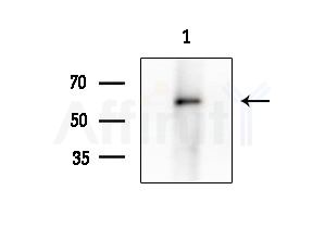Phospho-Tyrosine Hydroxylase (Ser31) Antibody - Western blot analysis of extracts from Rat brain, using Phospho-Tyrosine Hydroxylase (Ser31) Antibody at 1/1000 dilution.