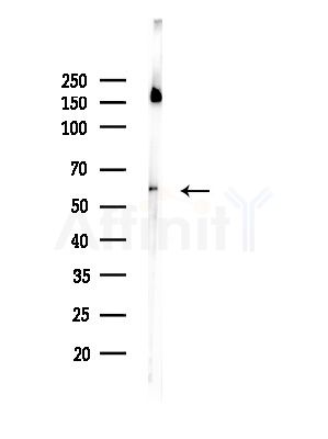 Phospho-Tyrosine Hydroxylase (Ser31) Antibody - Western blot analysis of lysates from Rat brain, using Phospho-Tyrosine Hydroxylase (Ser31) Antibody at 1/1000 dilution.