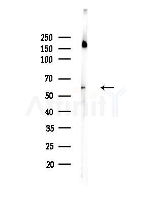 Phospho-Tyrosine Hydroxylase (Ser31) Antibody - Western blot analysis of lysates from Rat brain, using Phospho-Tyrosine Hydroxylase (Ser31) Antibody at 1/1000 dilution.