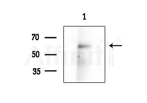 Phospho-Tyrosine Hydroxylase (Ser40) Antibody - Western blot analysis of extracts from Rat brain, using Phospho-Tyrosine Hydroxylase (Ser40) Antibody at 1/1000 dilution.
