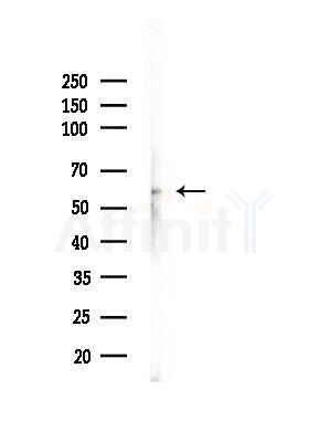 Phospho-Tyrosine Hydroxylase (Ser40) Antibody - Western blot analysis of lysates from Rat brain, using Phospho-Tyrosine Hydroxylase (Ser40) Antibody at 1/1000 dilution.