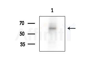 Phospho-Tyrosine Hydroxylase (Ser19) Antibody - Western blot analysis of extracts from Rat brain, using Phospho-Tyrosine Hydroxylase (Ser19) Antibody at 1/1000 dilution.