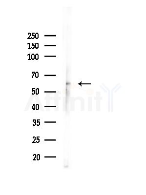 Phospho-Tyrosine Hydroxylase (Ser19) Antibody - Western blot analysis of lysates from Rat brain, using Phospho-Tyrosine Hydroxylase (Ser19) Antibody at 1/1000 dilution.