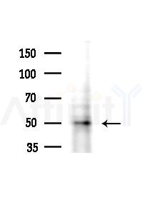 Phospho-hnRNP C1/C2 (Ser260) Antibody - Western blot analysis of lysates from COLO205 cells(heat-shock,45min treatment), using Phospho-hnRNP C1/C2 (Ser260) Antibody at 1/1000 dilution.