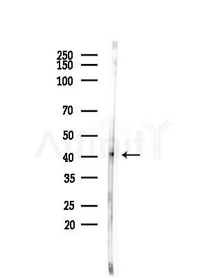 Phospho-hnRNP C1/C2 (Ser260) Antibody - Western blot analysis of lysates from COLO205 cells(heat-shock,45min treatment), using Phospho-hnRNP C1/C2 (Ser260) Antibody at 1/1000 dilution.