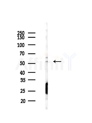 Phospho-Lyn (Tyr508) Antibody - Western blot analysis of lysates from COLO205 cells(heat-shock,45min treatment), using Phospho-Lyn (Tyr508) Antibody at 1/1000 dilution.