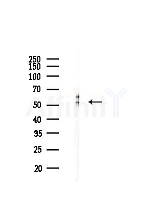 Phospho-Lyn (Tyr508) Antibody - Western blot analysis of lysates from Mouse lung, using Phospho-Lyn (Tyr508) Antibody at 1/1000 dilution.