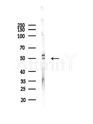 Phospho-Lyn (Tyr508) Antibody - Western blot analysis of lysates from Hela cells(LPS, 4h treatment), using Phospho-Lyn (Tyr508) Antibody at 1/1000 dilution.